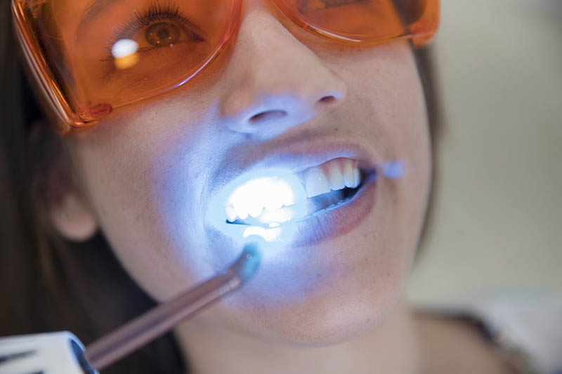 Mujer realizándose un blanqueamiento dental con Philips Zoom White Speed