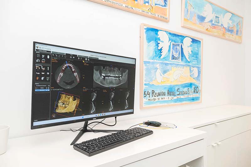 Ordenador con imagen de la radiografía de un paciente para su estudio